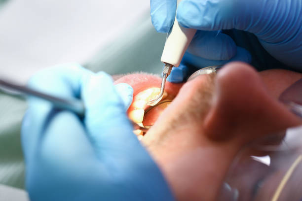 Best Cosmetic Emergency Dentistry in Sanford, NC